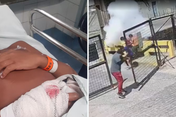 Erick Gabriel Gomes de Araújo perdeu o dedo após explosão de bomba na sede do Sport