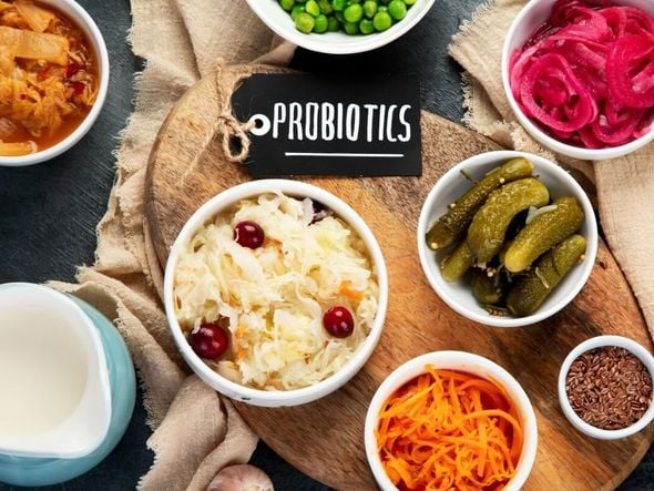 Imagem - 7 alimentos com probióticos para incluir na dieta