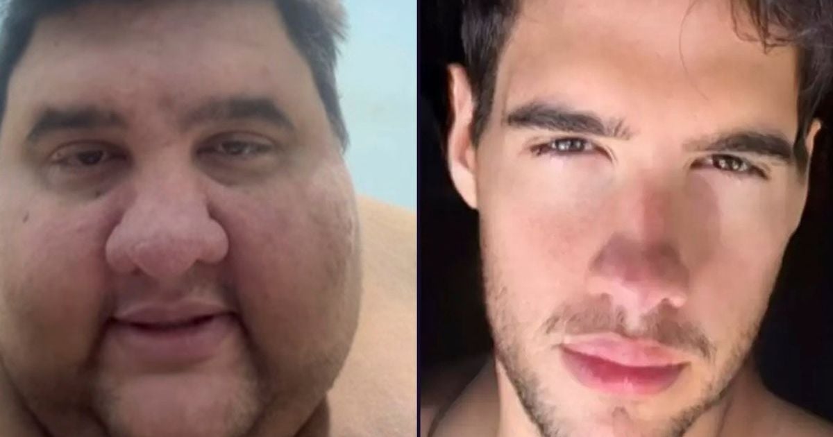 Imagem - Morre Gabriel Freitas, influenciador que já pesou 380kg e divulgava emagrecimento nas redes