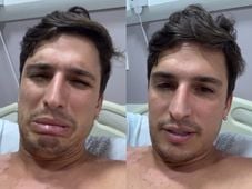 Imagem - Ex-BBB Felipe Prior é internado com infecção e surge com olho estourado