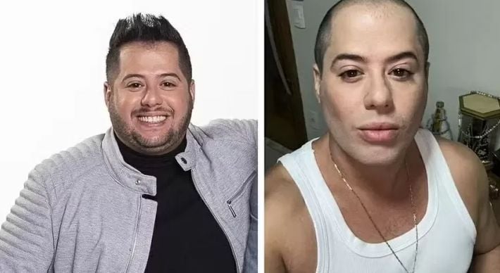 Imagem - Sertanejo Hugo, da dupla com Tiago, surpreende com mudança radical no rosto e corpo