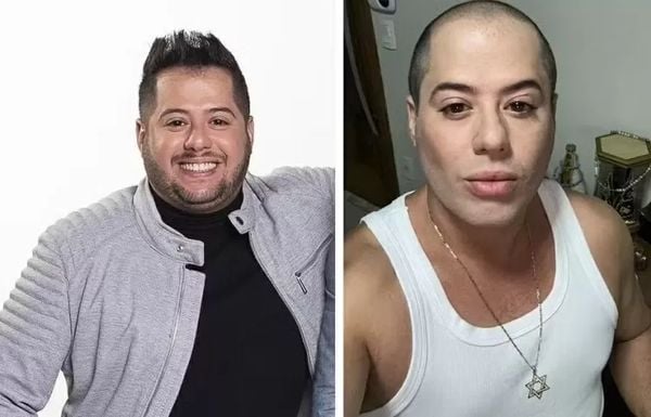 Antes e depois de Hugo da dupla Hugo e Tiago 