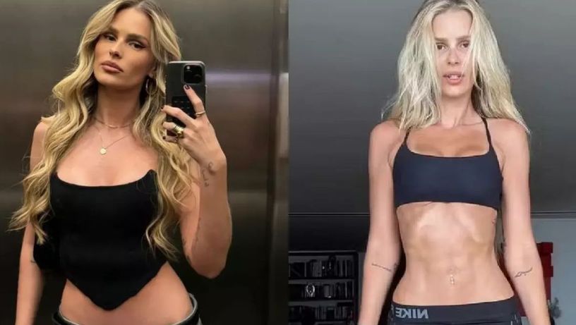 Imagem - 14kg mais magra, Yasmin Brunet revela diagnóstico de doença: 'Eu gritava de dor'