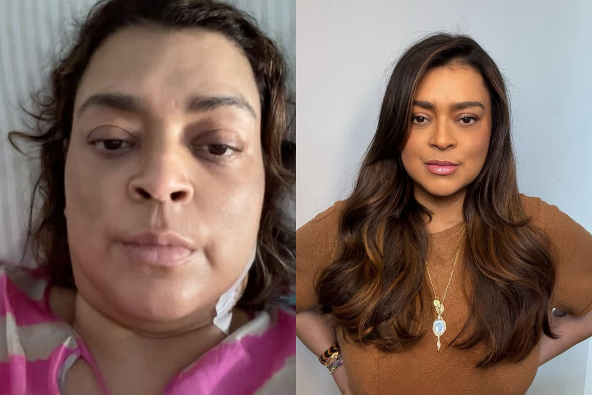 Preta Gil antes e depois por Reprodução / Redes Sociais