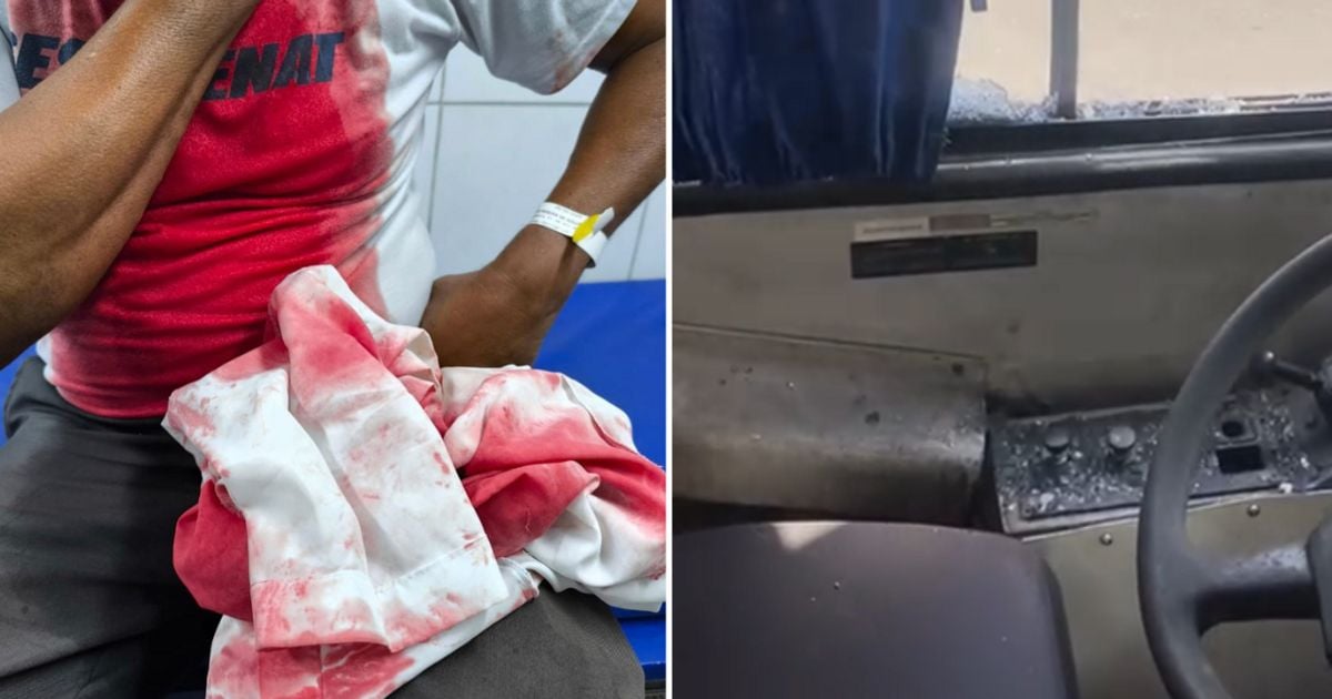 Imagem - Motorista de ônibus é agredido com pedrada após negar carona a passageiro em Salvador