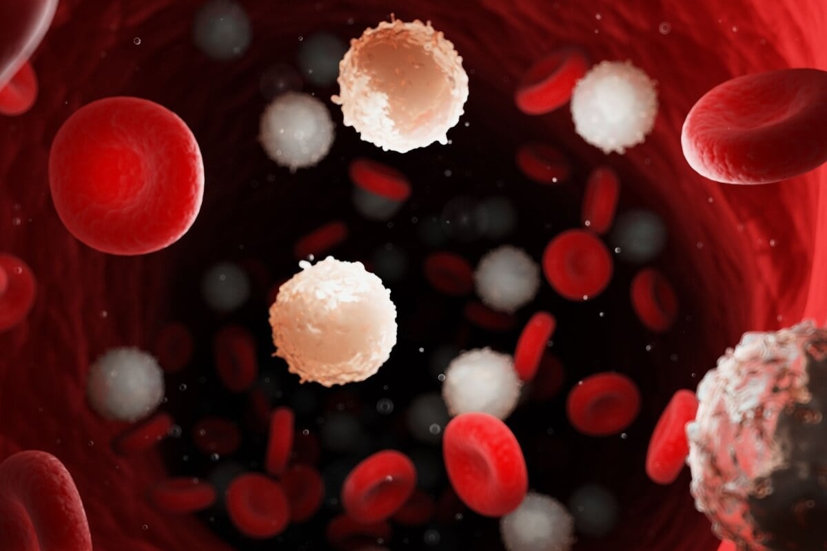 A leucemia é um câncer comum (Imagem: 3dMediSphere | Shutterstock)  por Imagem: 3dMediSphere | Shutterstock