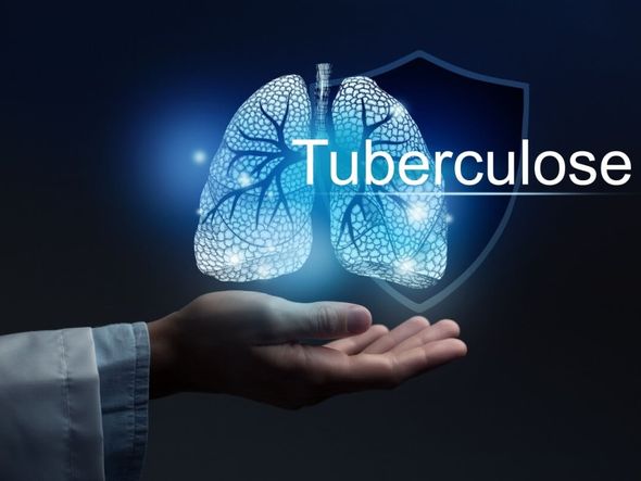 Imagem - 5 sintomas de alerta para a tuberculose