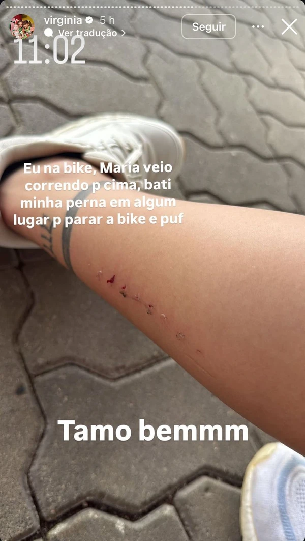 Virginia exibe machucado