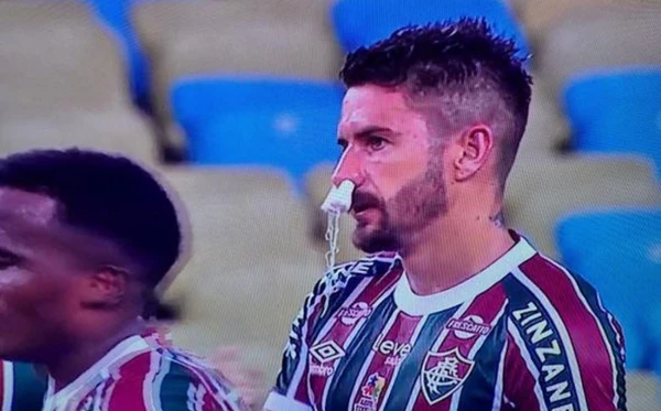 Everaldo com dois absorventes internos no nariz