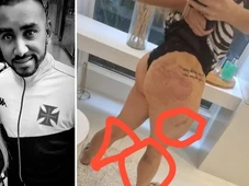 Imagem - Ex-amante que acusa Payet, do Vasco, de agressão diz que abandonou trabalho por medo: 'Vítima mais uma vez'