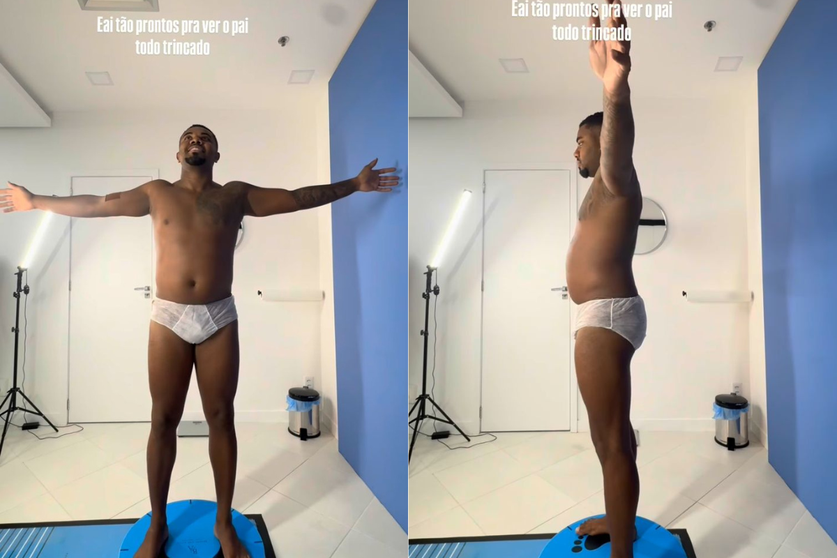 Davi Brito mostra pré operatório da Lipo HD por Reprodução / Redes Sociais