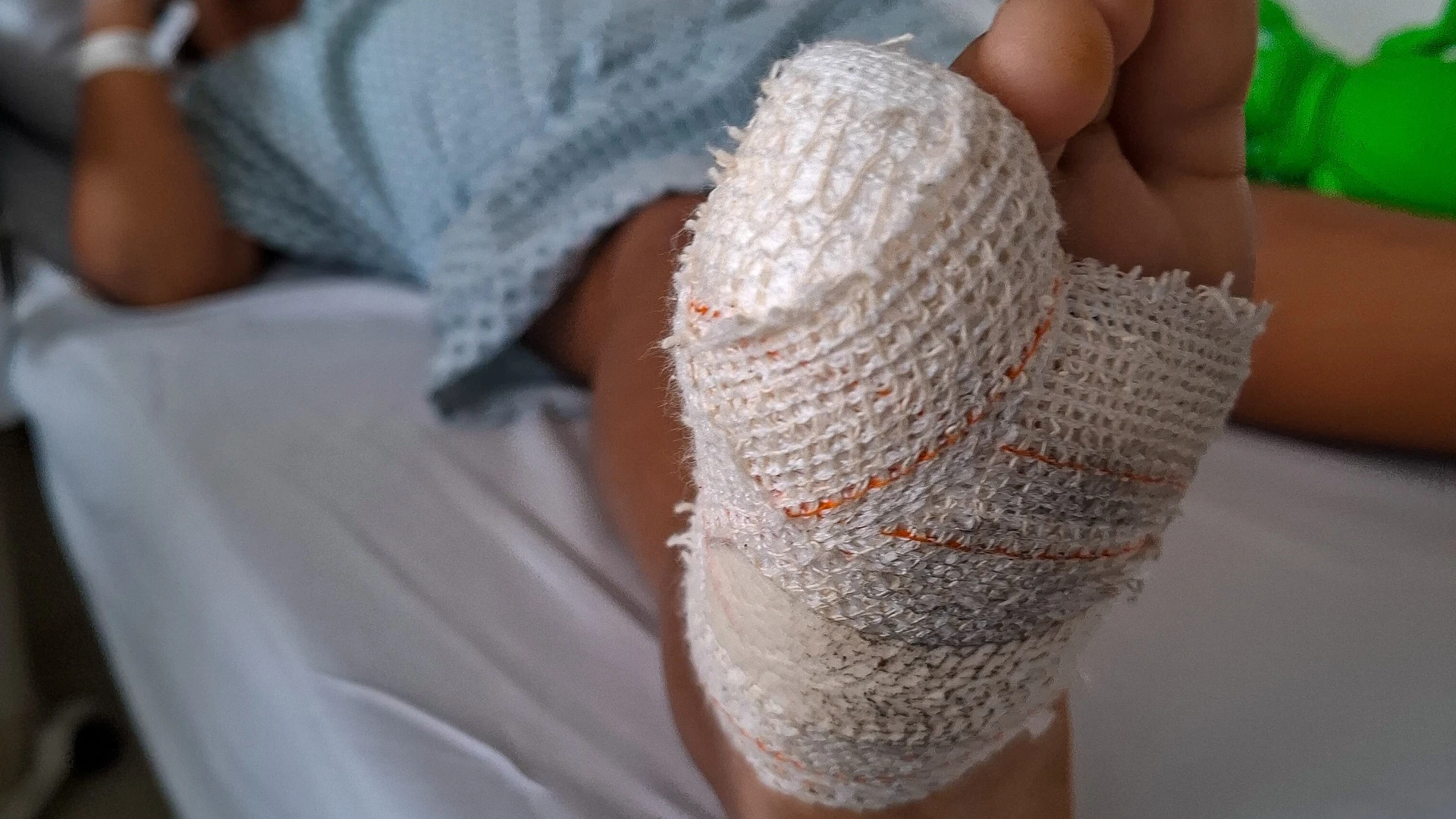 Imagem - Crianças são mutiladas em brinquedo de condomínio no Litoral Norte da Bahia