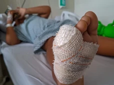 Imagem - Crianças são mutiladas em brinquedo de condomínio no Litoral Norte da Bahia