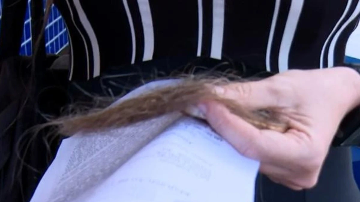 Diretora teve parte do cabelo arrancado durante a agressão