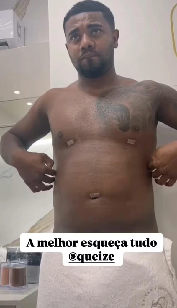 Davi Brito mostra barriga lipada nos Stories