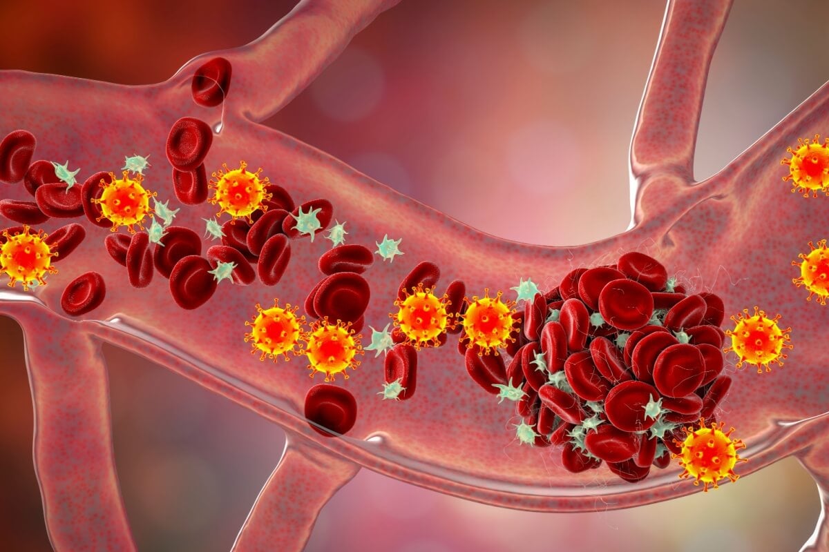 Diagnóstico precoce de trombofilia evita complicações graves (Imagem: Kateryna Kon | Shutterstock) 