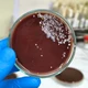 Imagem - Dois novos surtos de 'superfungo' faz Anvisa emitir alerta de risco