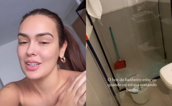 Larissa Santos falou nas redes sociais sobre acidente doméstico