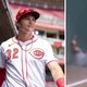 Imagem - Jogador de beisebol quebra o antebraço durante jogo uma semana após estreia