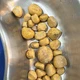 Imagem - Médico encontra 35 pedras na bexiga de homem que bebia coca-cola todos os dias