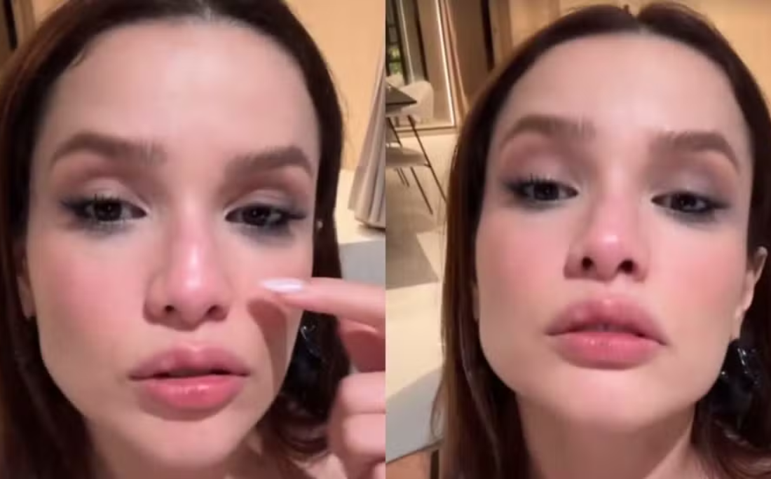 Juliette mostra machucado no rosto após bater na porta por Reprodução