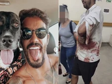 Imagem - Pintor é atacado por cães em mansão de ex-De Férias com Ex: 'Mordeu minha perna'