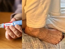 Imagem - 'Pé de Ozempic': pacientes que usam remédio para emagrecer relatam pesadelo