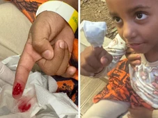 Imagem - Criança é atacada por piranhas e perde parte do dedo na Bahia: 'Muito sangue'