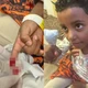 Imagem - Criança é atacada por piranhas e perde parte do dedo na Bahia: 'Muito sangue'