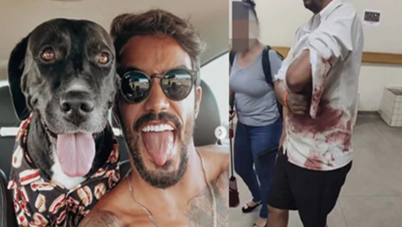 Imagem - Pintor é atacado por cães em mansão de ex-De Férias com Ex: 'Mordeu minha perna'