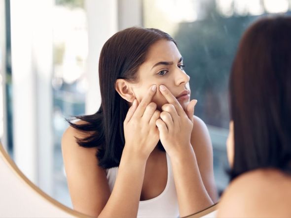 Imagem - 7 dicas para controlar a acne na vida adulta