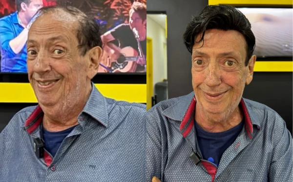 Antes e depois de Marcos Oliveira