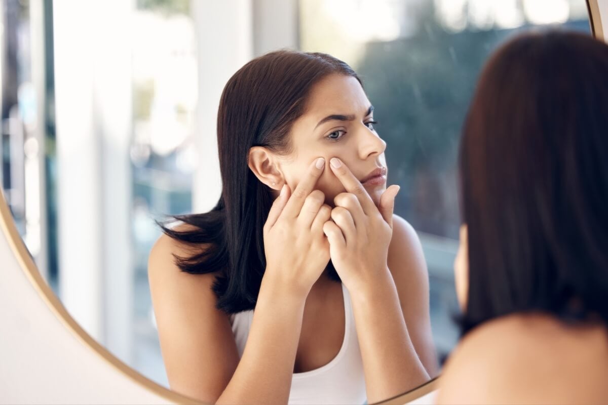 A acne na vida adulta é comum e pode ser tratada com cuidados específicos (Imagem: PeopleImages.com - Yuri A | Shutterstock) 