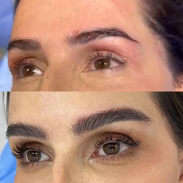 Antes e depois de Deborah Secco