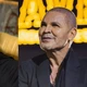 Imagem - Hoje careca, Eduardo Costa já teve cabelão e 25kg a mais; veja o antes e depois