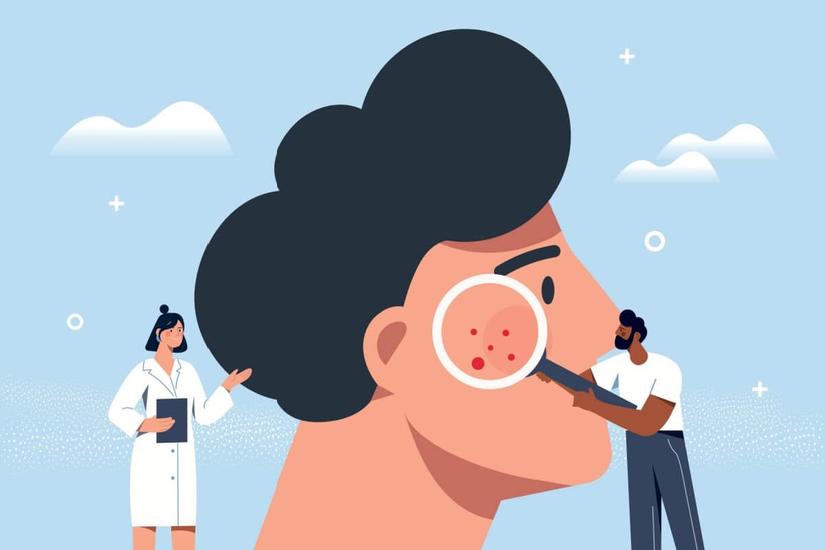 O câncer de pele é uma doença silenciosa e agressiva (Imagem: mentalmind | Shutterstock)