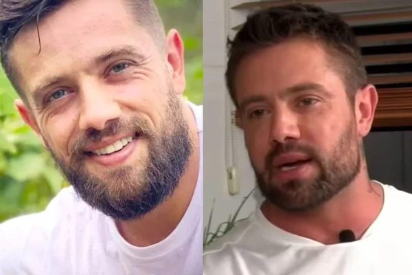 Rafael Cardoso antes e depois
