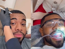 Imagem - Davi Brito faz botox e anuncia procedimento nos dentes