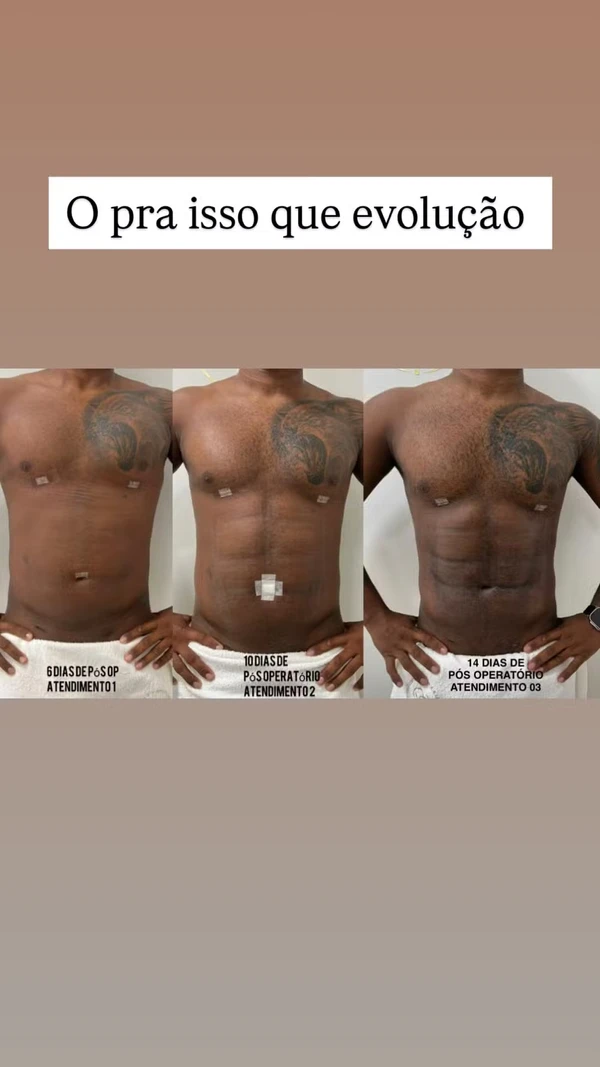 Antes e depois de Davi Brito