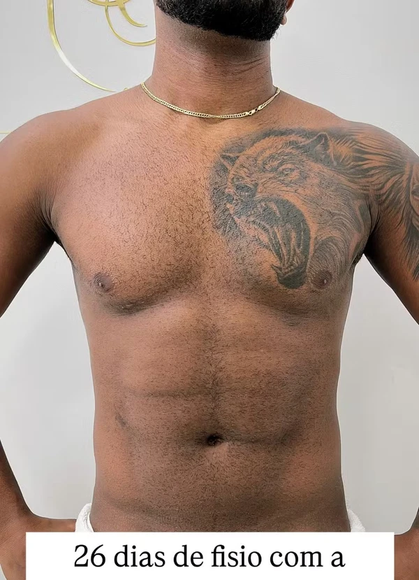Antes e depois de Davi Brito por Reprodução
