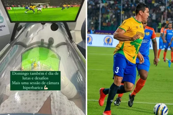Lúcio está em tratamento após sofrer queimaduras em 18% do corpo