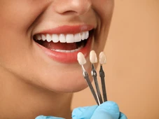 Imagem - Saiba três riscos de usar lentes de contato para os dentes