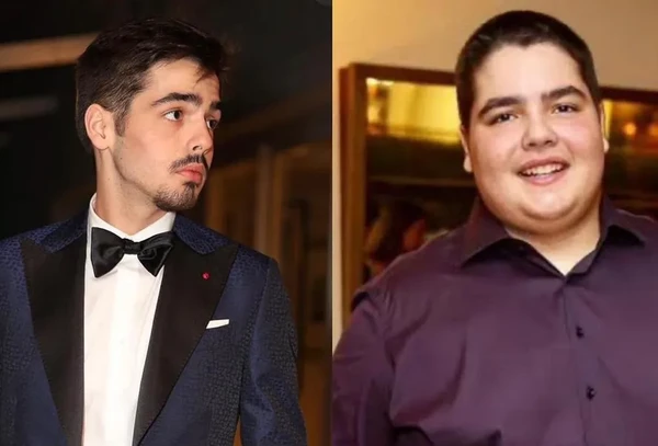 Antes e depois de João Silva por Reprodução