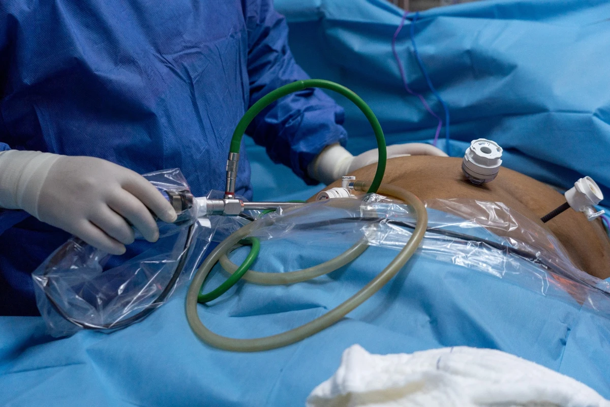 Cirurgia bariátrica teve diretrizes atualizadas