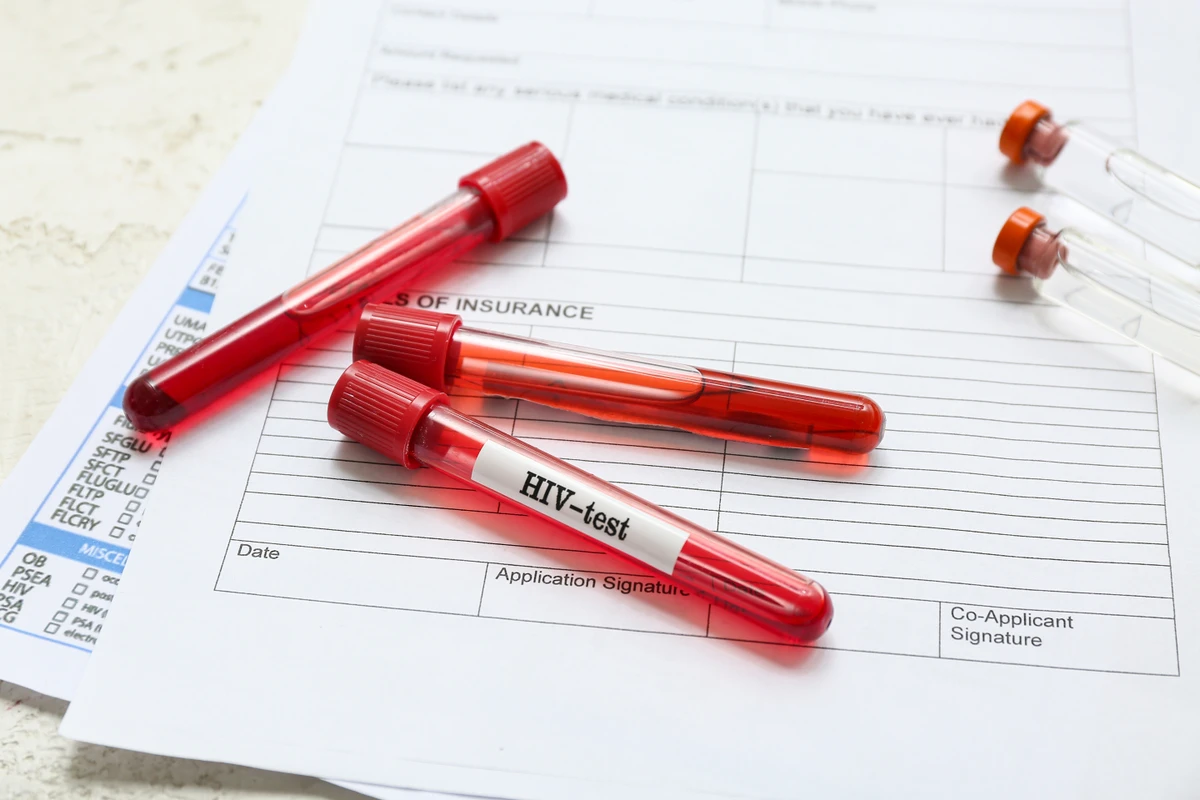 Uma outra forma de prevenção e controle é fazer testes períodos de HIV e trocar com o parceiro por Shutterstock
