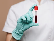 Imagem - Junho Laranja alerta para importância de exames de sangue regulares para diagnóstico precoce de leucemias