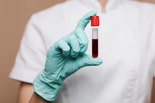 Exames de sangue de rotina são essenciais para o diagnóstico precoce e tratamento adequado