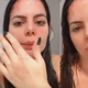 Imagem - Panela explode e queima corpo de ex-Casamento às Cegas Brasil, que está grávida