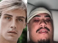 Imagem - Caso Bruno Krupp: vítima revela o que ouviu antes do espancamento