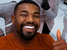 Imagem - Davi Brito faz harmonização no rosto; veja antes e depois